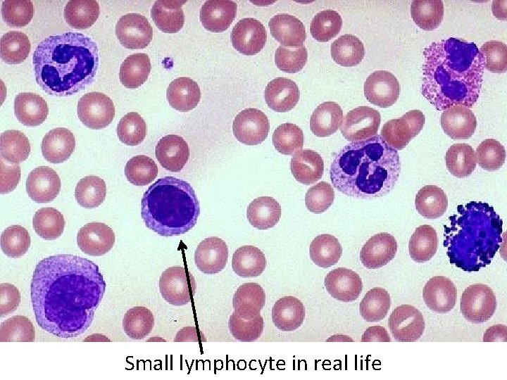 Small lymphocyte in real life 