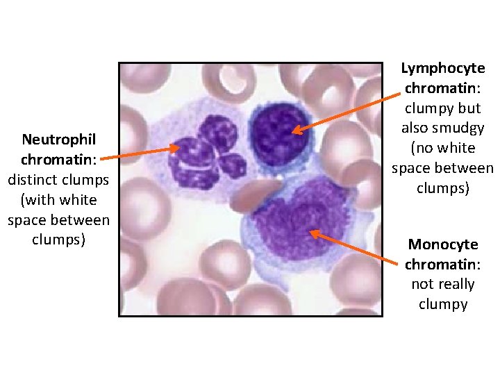 Neutrophil chromatin: distinct clumps (with white space between clumps) Lymphocyte chromatin: clumpy but also
