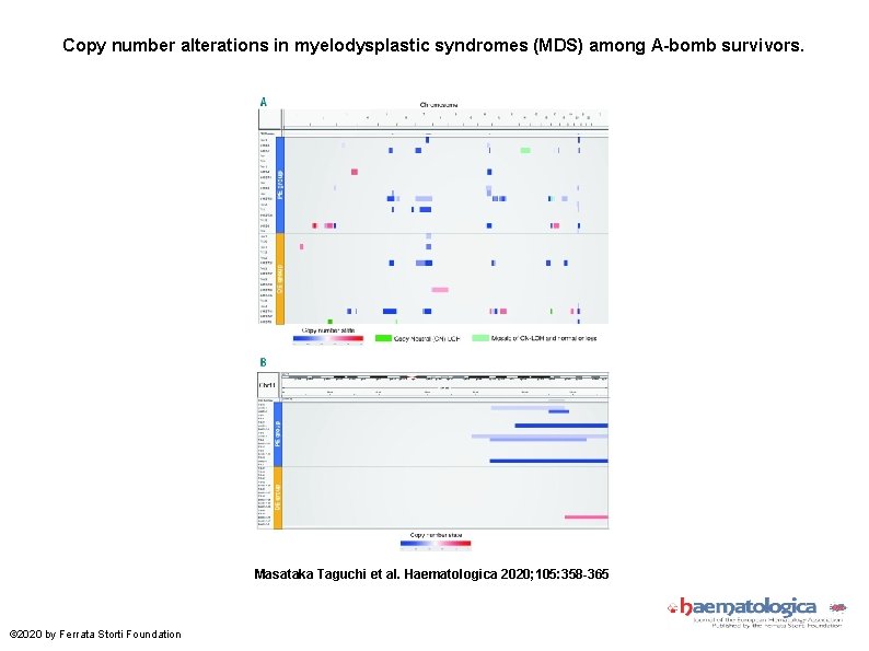 Copy number alterations in myelodysplastic syndromes (MDS) among A-bomb survivors. Masataka Taguchi et al.