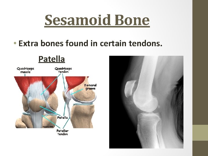 Sesamoid Bone • Extra bones found in certain tendons. Patella 