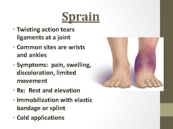 Sprain • Twisting action tears ligaments at a joint • Common sites are wrists