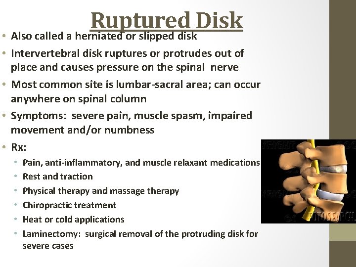 Ruptured Disk • Also called a herniated or slipped disk • Intervertebral disk ruptures