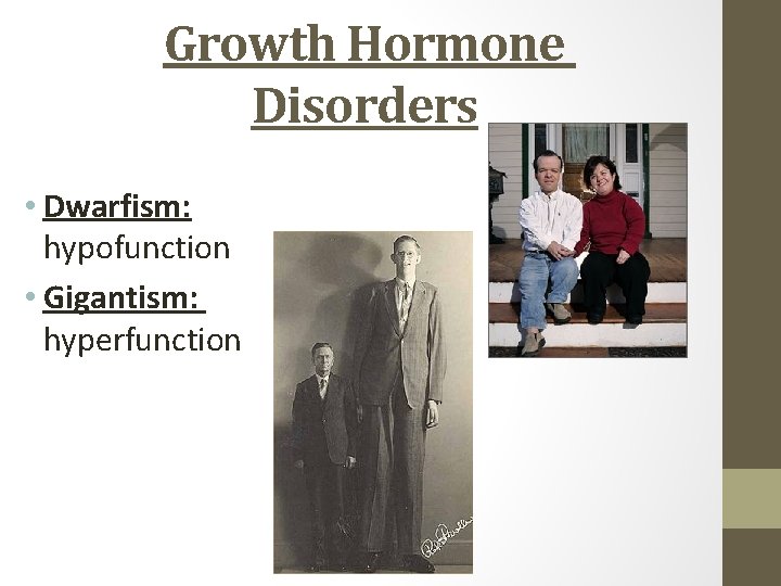 Growth Hormone Disorders • Dwarfism: hypofunction • Gigantism: hyperfunction 