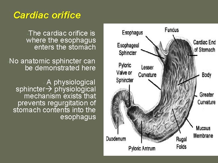 Cardiac orifice -The cardiac orifice is where the esophagus enters the stomach -No anatomic