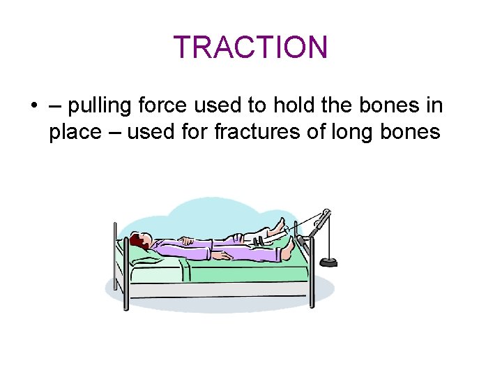 TRACTION • – pulling force used to hold the bones in place – used TRACTION • – pulling force used to hold the bones in place – used