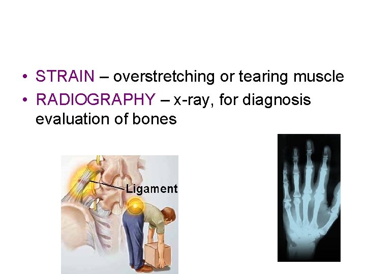  • STRAIN – overstretching or tearing muscle • RADIOGRAPHY – x-ray, for diagnosis