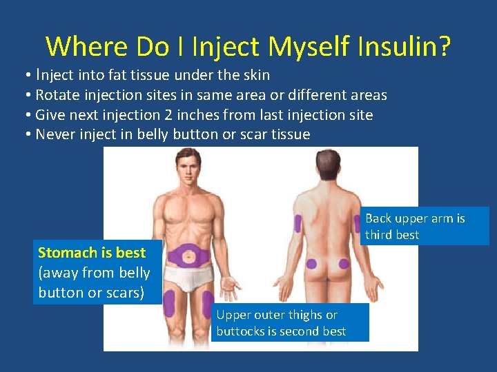 Where Do I Inject Myself Insulin? • Inject into fat tissue under the skin