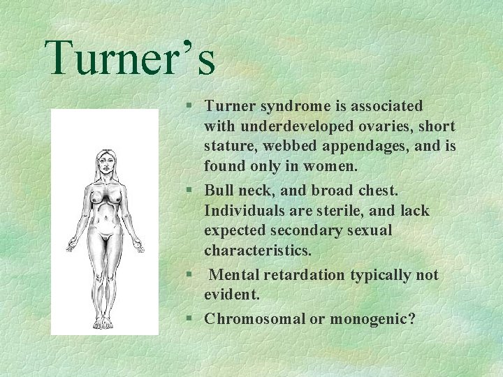 Turner’s § Turner syndrome is associated with underdeveloped ovaries, short stature, webbed appendages, and