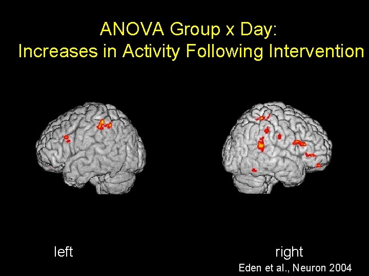 ANOVA Group x Day: Increases in Activity Following Intervention left right Eden et al.