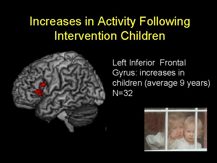 Increases in Activity Following Intervention Children Left Inferior Frontal Gyrus: increases in children (average