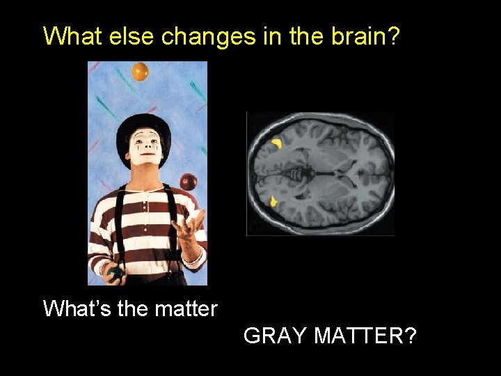 What else changes in the brain? What’s the matter GRAY MATTER? 