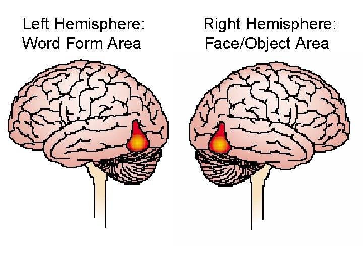 Left Hemisphere: Right Hemisphere: Word Form Area Face/Object Area 
