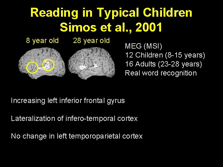 Reading in Typical Children Simos et al. , 2001 8 year old 28 year