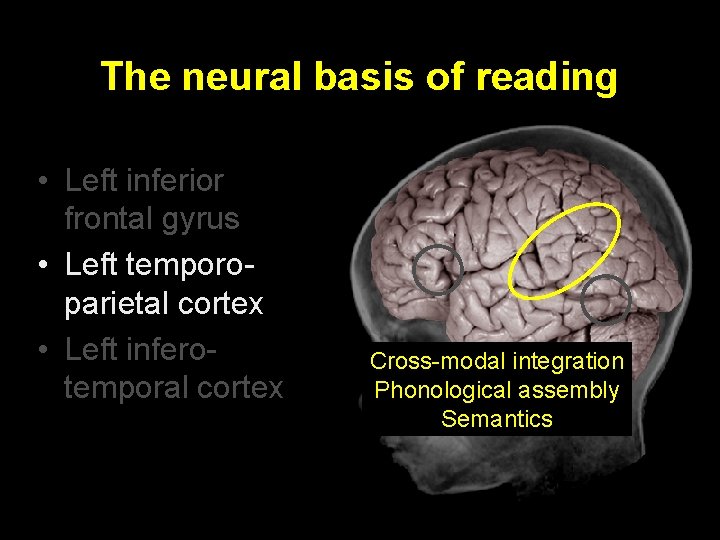 The neural basis of reading • Left inferior frontal gyrus • Left temporoparietal cortex