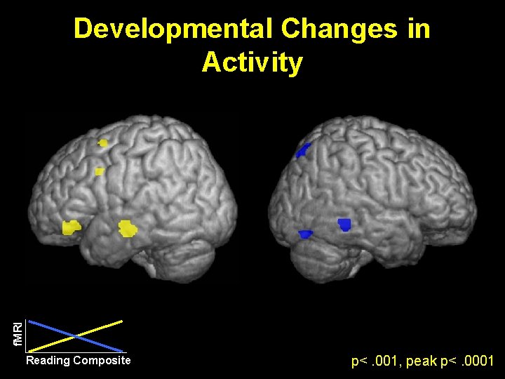 f. MRI Developmental Changes in Activity Reading Composite p<. 001, peak p<. 0001 