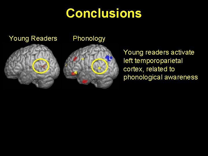Conclusions Young Readers Phonology Young readers activate left temporoparietal cortex, related to phonological awareness