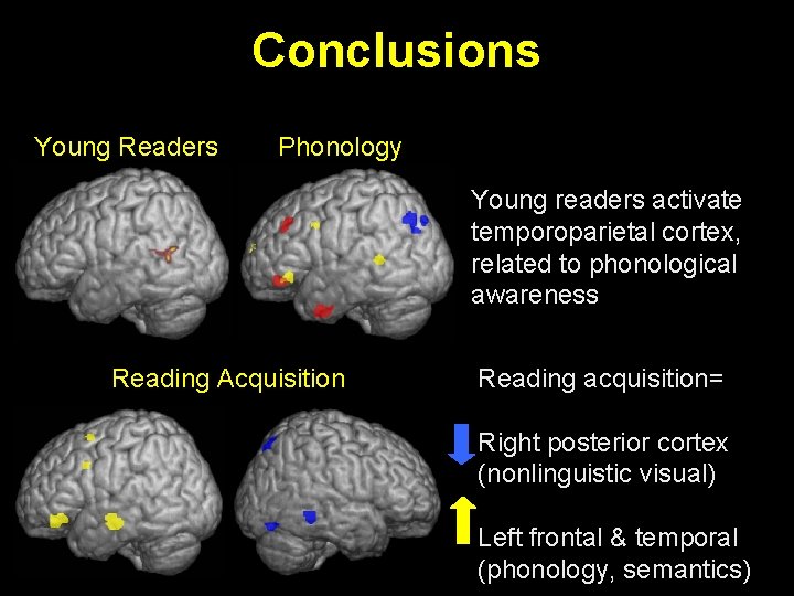 Conclusions Young Readers Phonology Young readers activate temporoparietal cortex, related to phonological awareness Reading