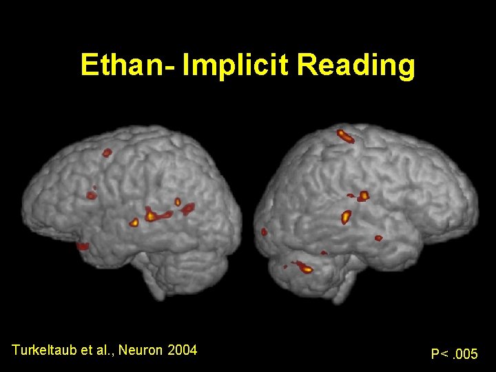 Ethan- Implicit Reading Turkeltaub et al. , Neuron 2004 P<. 005 