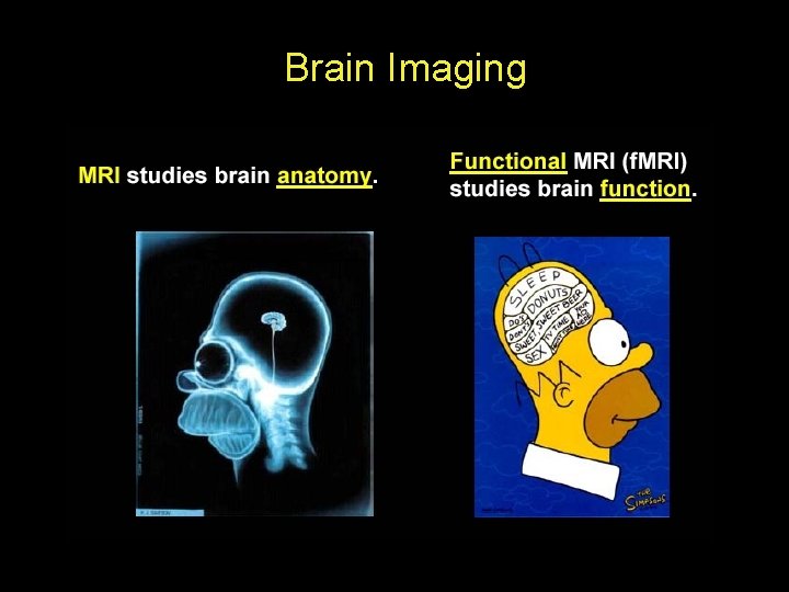 Brain Imaging 