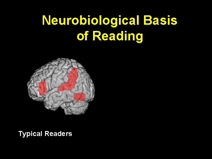 Neurobiological Basis of Reading Typical Readers 