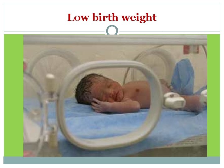 Low birth weight 