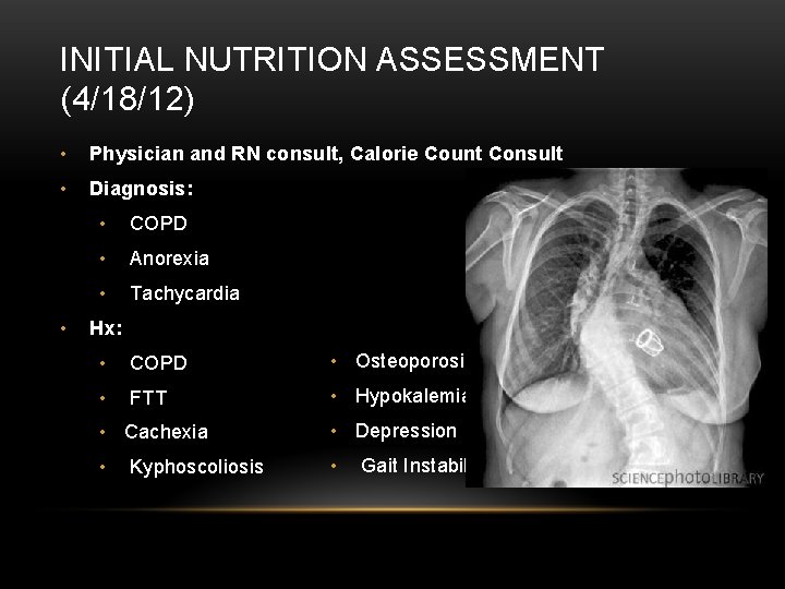 INITIAL NUTRITION ASSESSMENT (4/18/12) • Physician and RN consult, Calorie Count Consult • Diagnosis: INITIAL NUTRITION ASSESSMENT (4/18/12) • Physician and RN consult, Calorie Count Consult • Diagnosis: