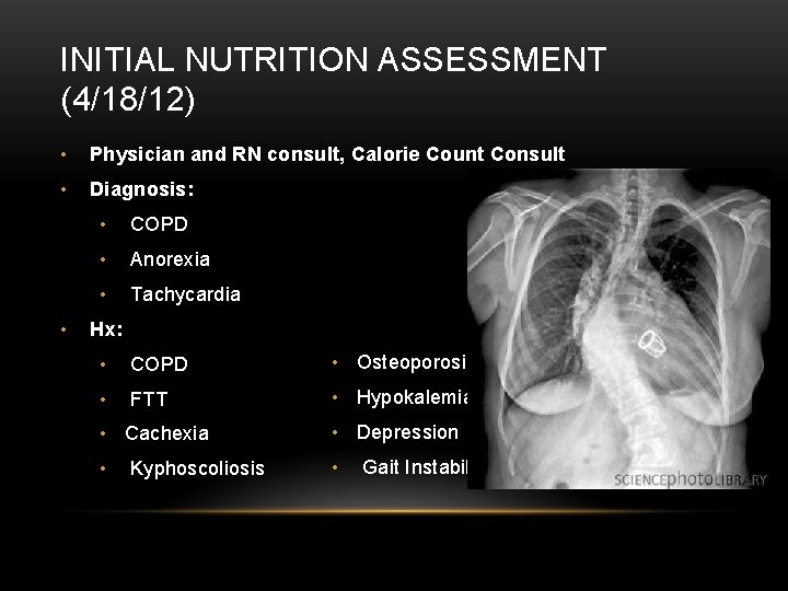 INITIAL NUTRITION ASSESSMENT (4/18/12) • Physician and RN consult, Calorie Count Consult • Diagnosis: