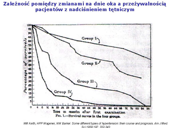 Zależność pomiędzy zmianami na dnie oka a przeżywalnością pacjentów z nadciśnieniem tętniczym NM Keith,