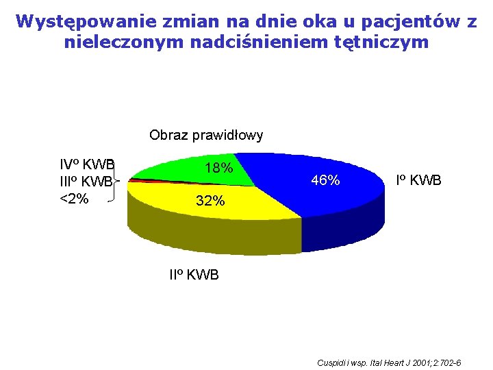 Występowanie zmian na dnie oka u pacjentów z nieleczonym nadciśnieniem tętniczym Obraz prawidłowy IVº