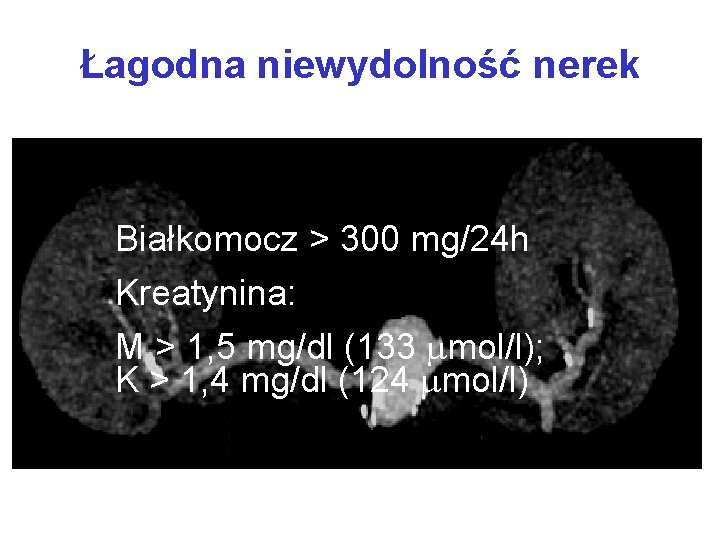 Łagodna niewydolność nerek Białkomocz > 300 mg/24 h Kreatynina: M > 1, 5 mg/dl