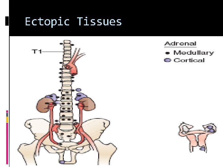 Ectopic Tissues 