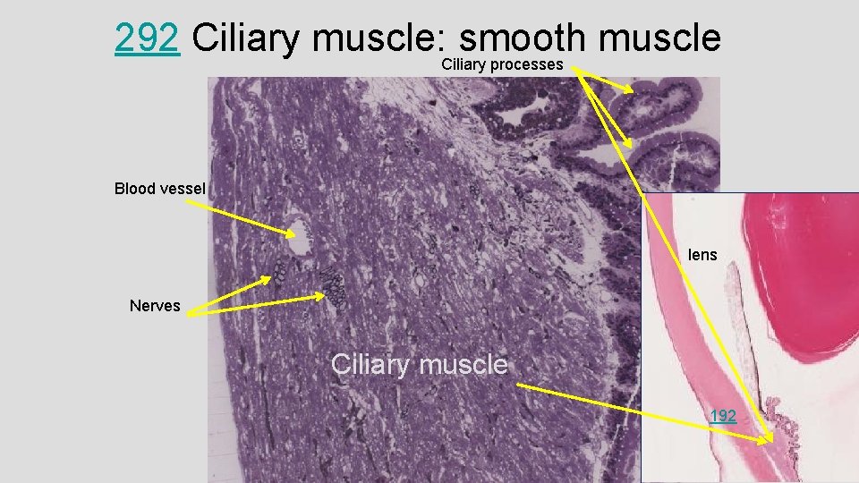 292 Ciliary muscle: Ciliary smooth muscle processes Blood vessel lens Nerves Ciliary muscle 192