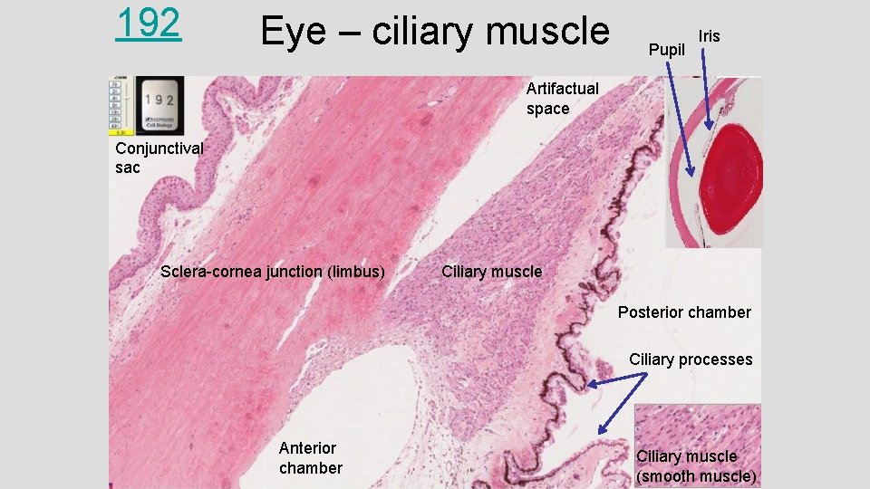 192 Eye – ciliary muscle Pupil Iris Artifactual space Conjunctival sac Sclera-cornea junction (limbus)
