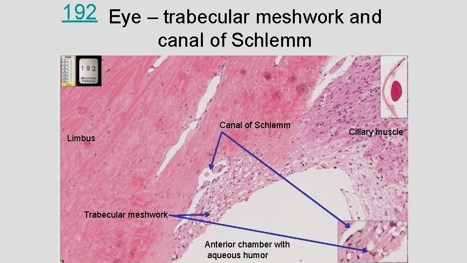 192 Eye – trabecular meshwork and canal of Schlemm Canal of Schlemm Limbus Trabecular