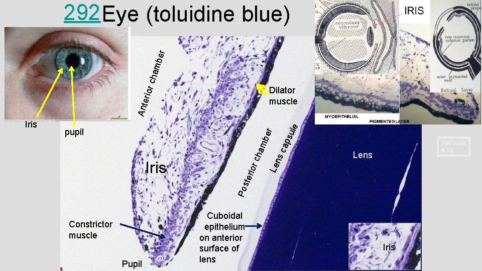 mbe r 292 Eye (toluidine blue) cha Lens ule sc Len teri o Iris