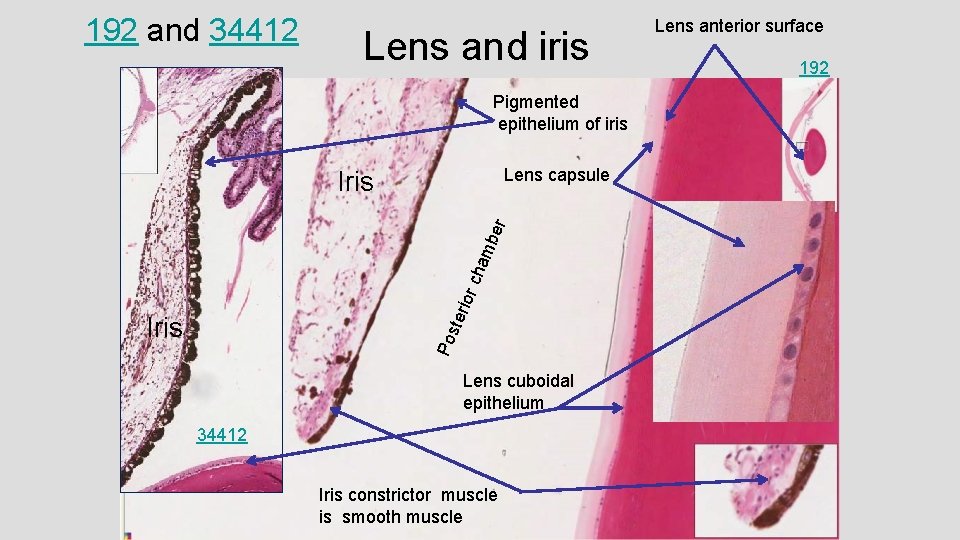 192 and 34412 Lens and iris Pigmented epithelium of iris Lens capsule teri o