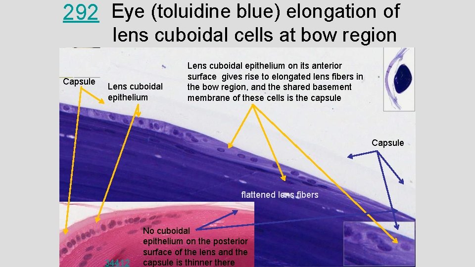 292 Eye (toluidine blue) elongation of lens cuboidal cells at bow region Capsule Lens