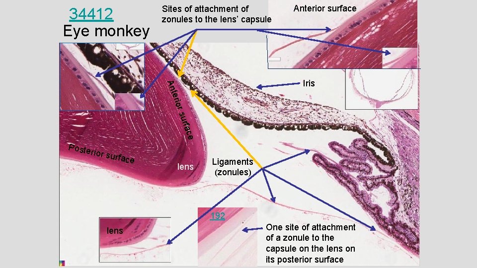 34412 Eye monkey Sites of attachment of zonules to the lens’ capsule Anterior surface