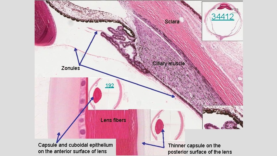 Sclara 34412 Ciliary muscle Zonules 192 Lens fibers Capsule and cuboidal epithelium on the