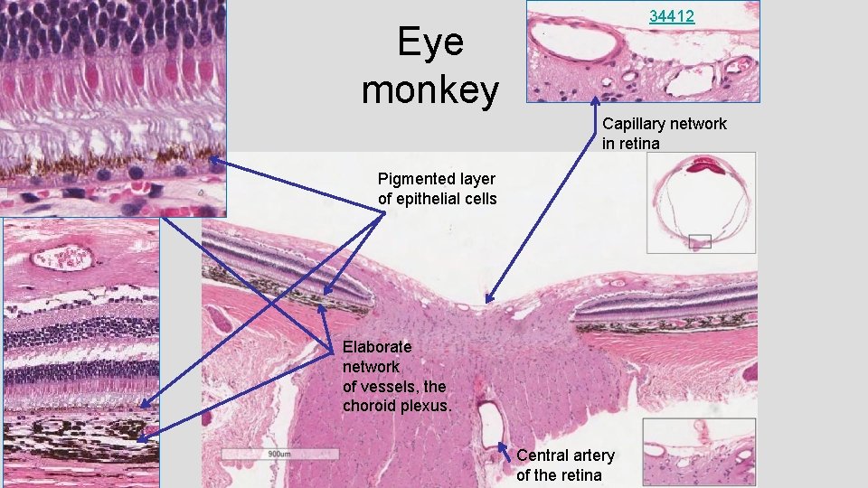 34412 Eye monkey Capillary network in retina Pigmented layer of epithelial cells Elaborate network