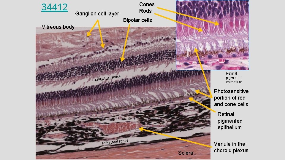 34412 Cones Rods Ganglion cell layer Bipolar cells Vitreous body Retinal pigmented epithelium space