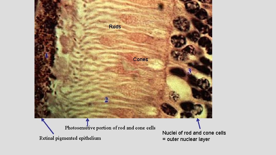 Rods Cones Photosensitive portion of rod and cone cells Retinal pigmented epithelium Nuclei of