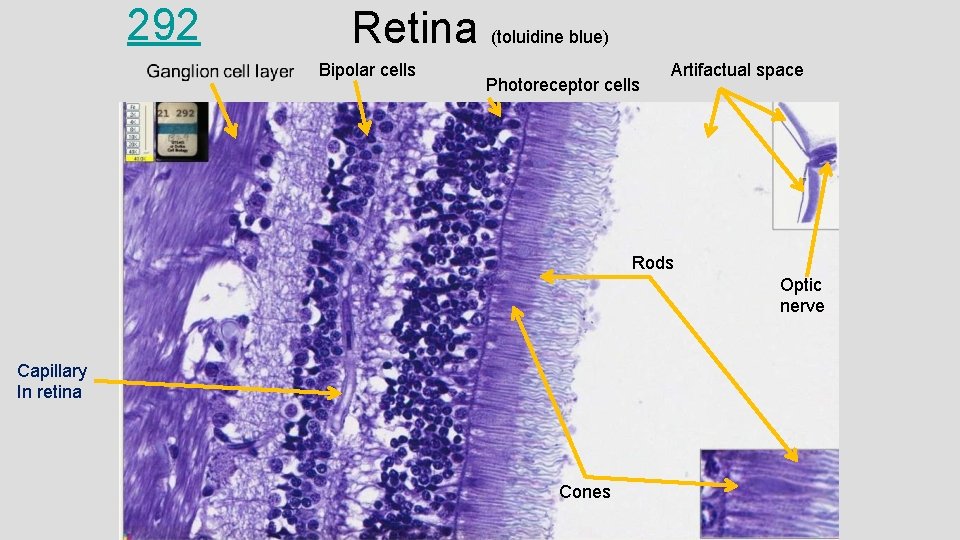 292 Retina (toluidine blue) Bipolar cells Photoreceptor cells Artifactual space Rods Optic nerve Capillary