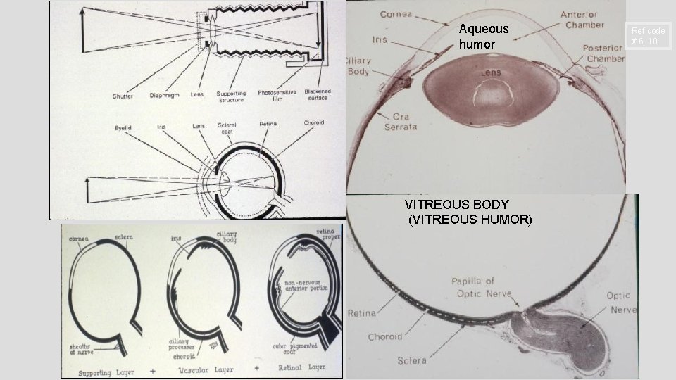 Aqueous humor VITREOUS BODY (VITREOUS HUMOR) Ref code # 6, 10 