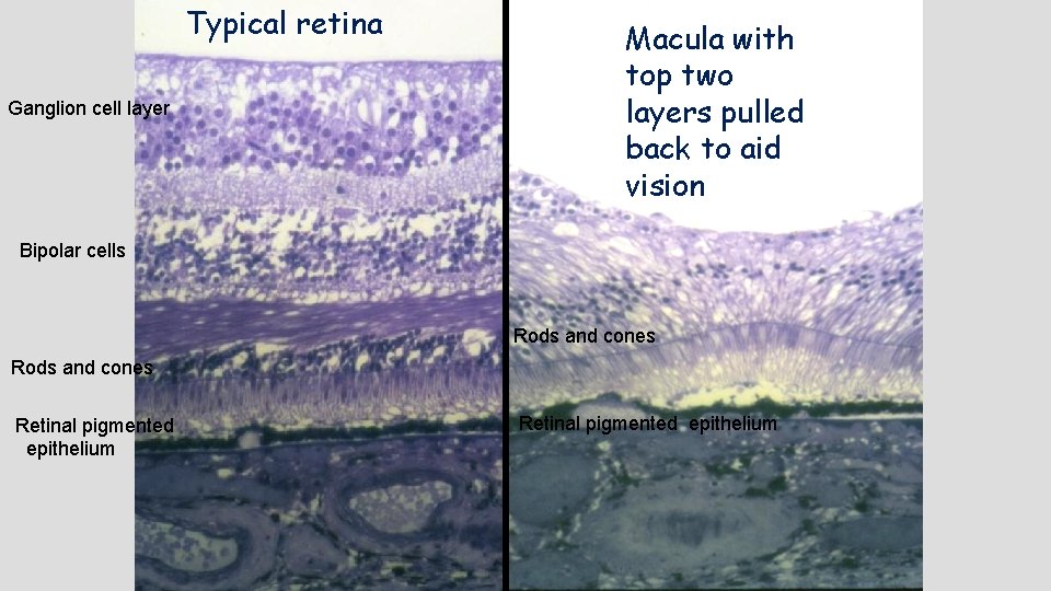 Typical retina Ganglion cell layer Macula with top two layers pulled back to aid
