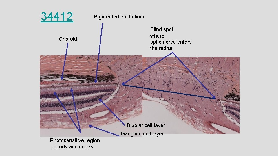 34412 Pigmented epithelium Choroid Blind spot where optic nerve enters the retina Bipolar cell