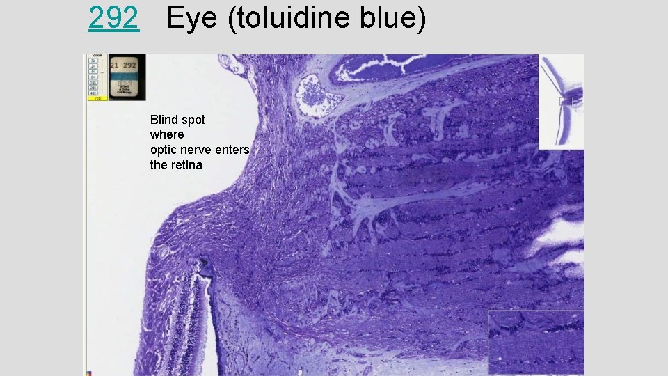 292 Eye (toluidine blue) Blind spot where optic nerve enters the retina 