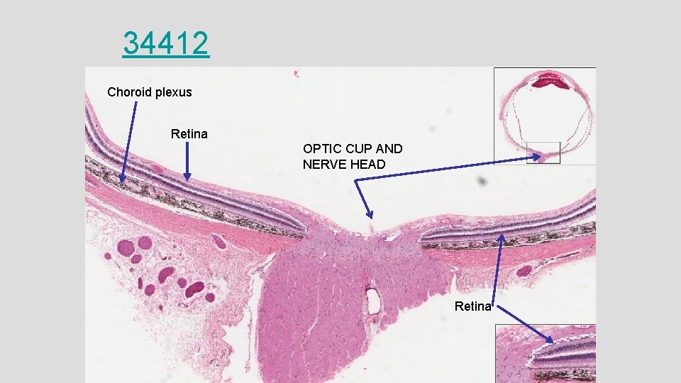 34412 Choroid plexus Retina OPTIC CUP AND NERVE HEAD Retina 