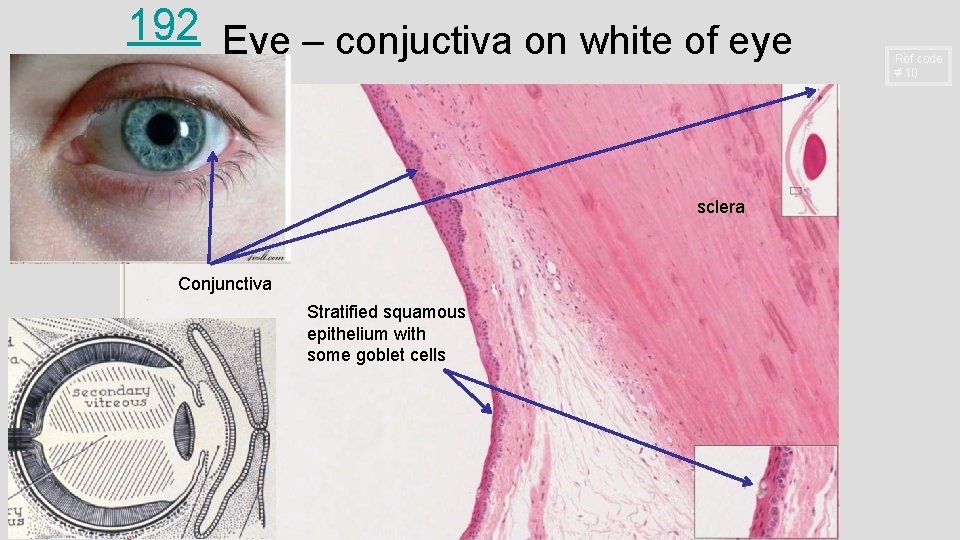 192 Eye – conjuctiva on white of eye sclera Conjunctiva Stratified squamous epithelium with