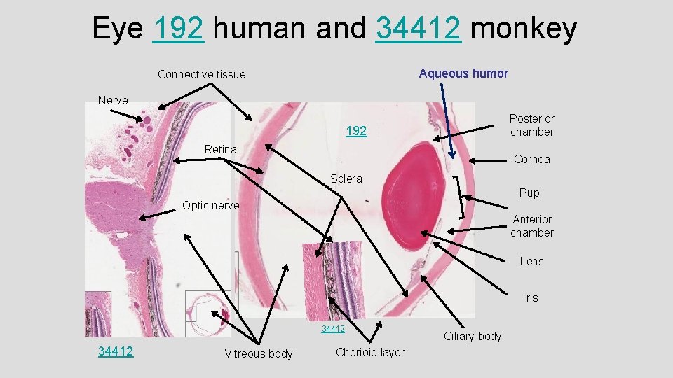 Eye 192 human and 34412 monkey Aqueous humor Connective tissue Nerve Posterior chamber 192
